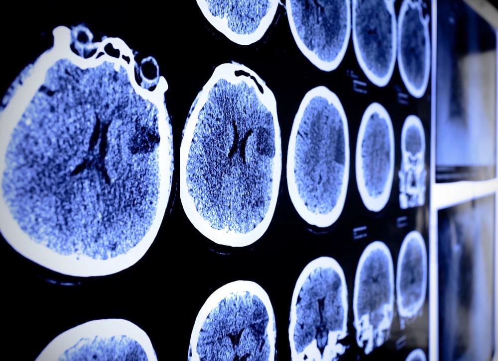 Cleveland brain injury lawyer info banner