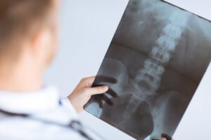What Damages Are Recoverable in Akron Slip and Fall Cases?